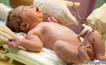 What it is Cord blood banking, why consider it
